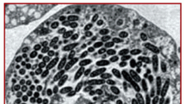 Preventing Legionnaires’ Disease in Cooling Towers HPAC Engineering