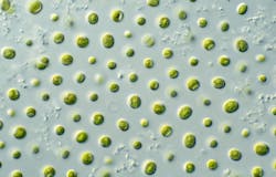 Csiro Science Image 10697 Microalgae 62228cf6524b9 Csiro Science Image 10697 Microalgae 62228cf6524b9