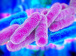 Legionella Large 963x722 649ed978ece3e Legionella Large 963x722 649ed978ece3e